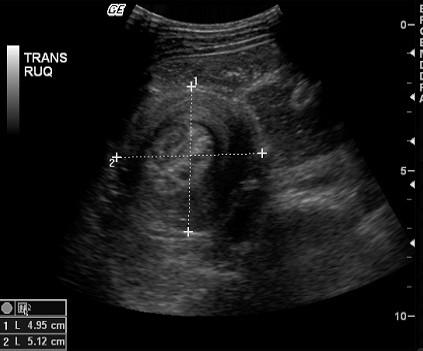 Descriptive text is not available for this image