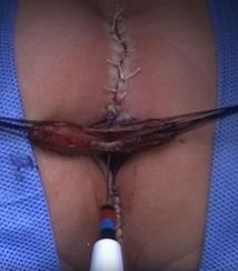 Descriptive text is not available for this image