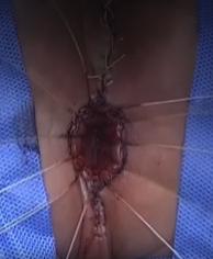 Descriptive text is not available for this image