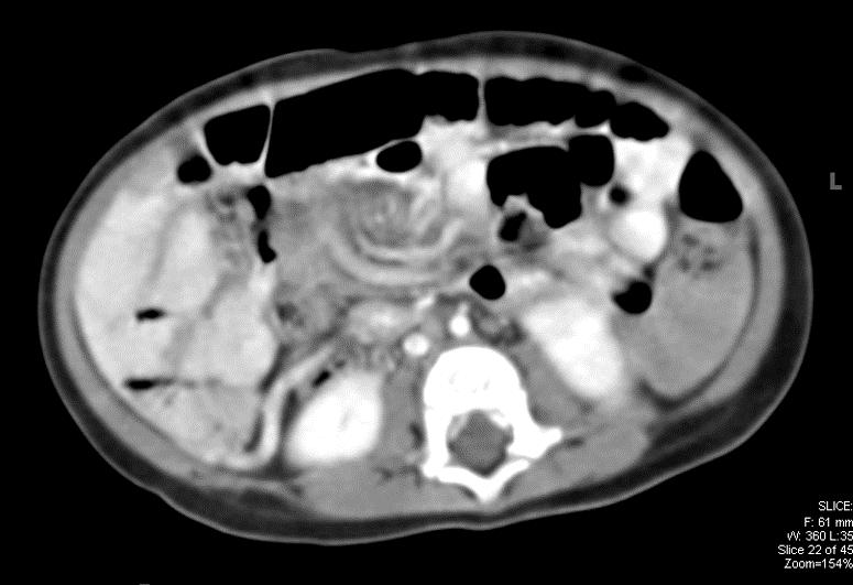 Descriptive text is not available for this image