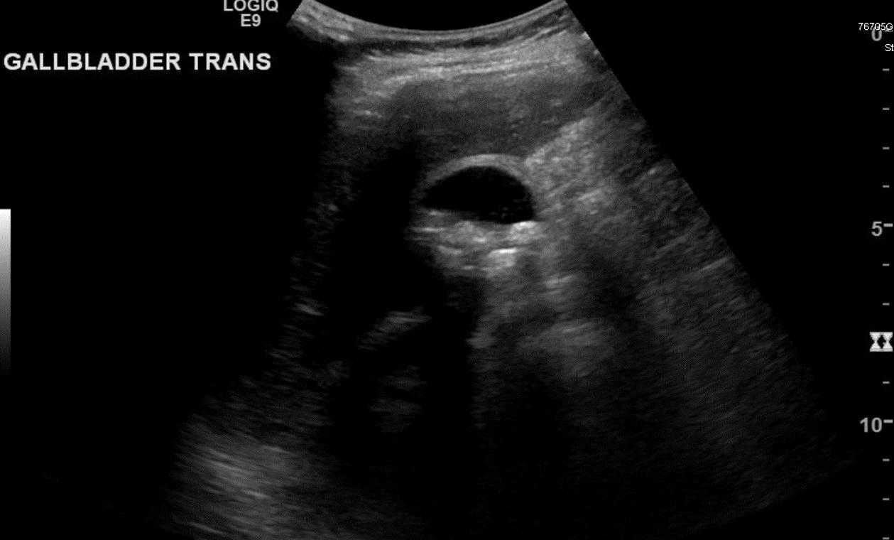 Descriptive text is not available for this image