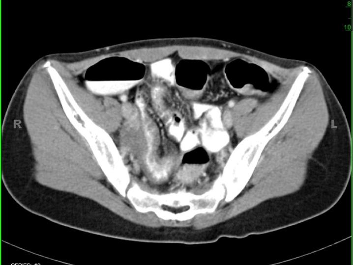 Descriptive text is not available for this image