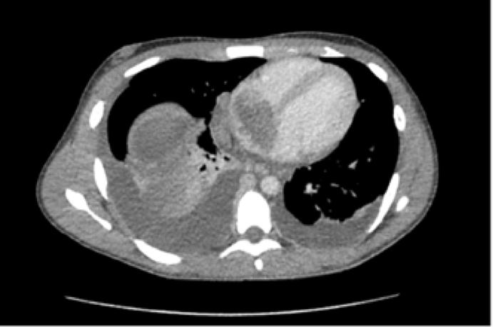 Descriptive text is not available for this image