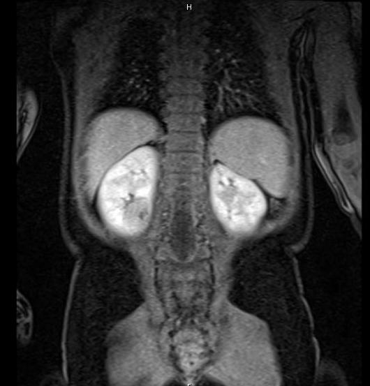 Descriptive text is not available for this image