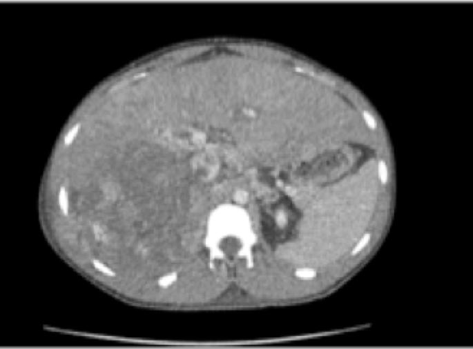 Descriptive text is not available for this image