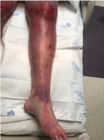 Descriptive text is not available for this image