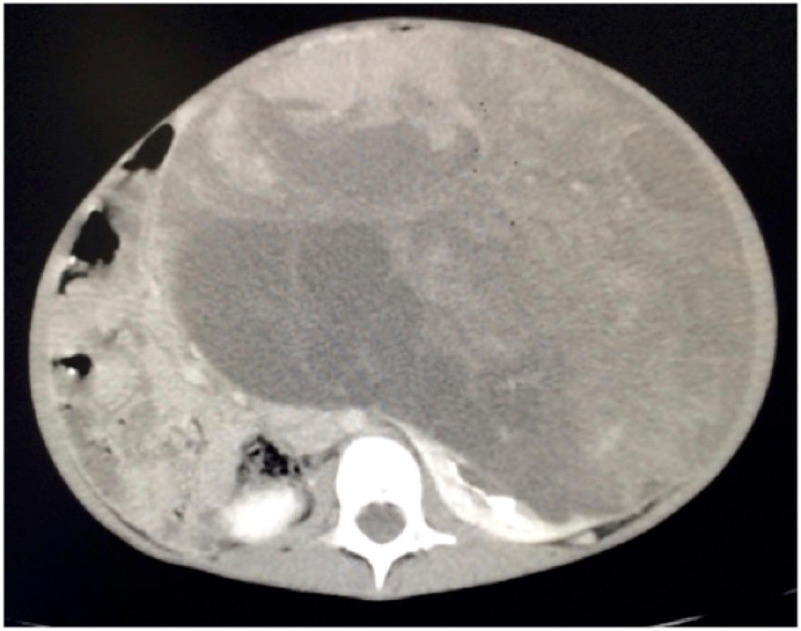 Descriptive text is not available for this image