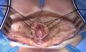 Descriptive text is not available for this image