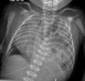 Descriptive text is not available for this image