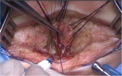 Descriptive text is not available for this image