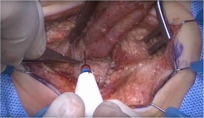 Descriptive text is not available for this image