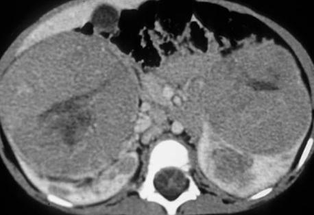 Descriptive text is not available for this image